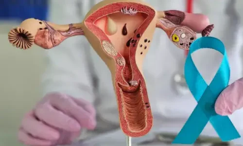 Cervical Cancer