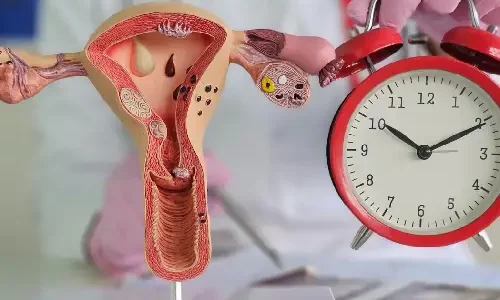 menopause